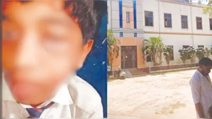 Mysuru Teacher Booked for Allegedly Assaulting 16-Year-Old Student