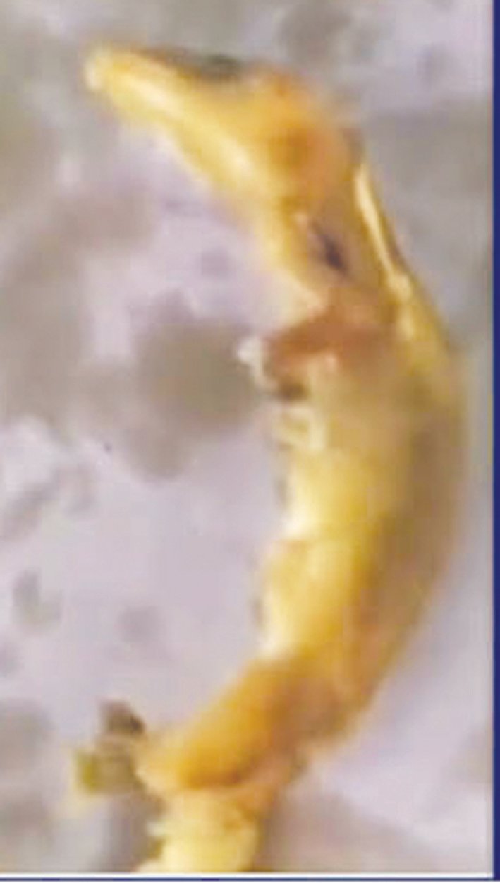 Seven Hospitalised in Chandrapur After Suspected Food Poisoning; Lizard Reportedly Found in Chivda Packet