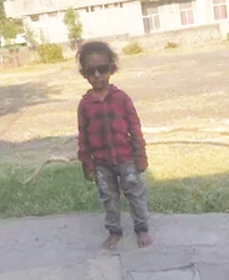 Four-Year-Old Boy Mauled to Death by Stray Dog in Kalaburagi